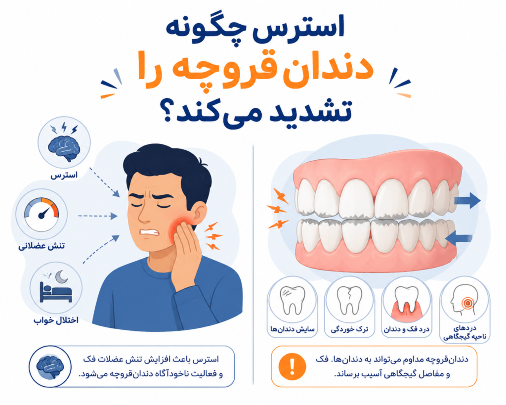 تصویر نزدیک از یک دندان، با نشانگر ساییدگی و ترک‌خوردگی، نماد اثرات دندان‌قروچه طولانی‌مدت